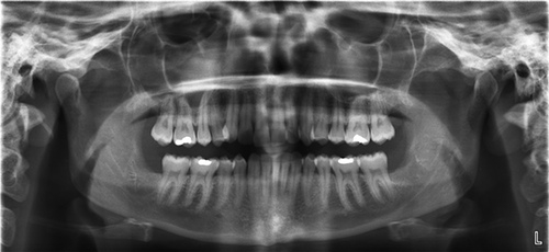 Dental Radyoloji 